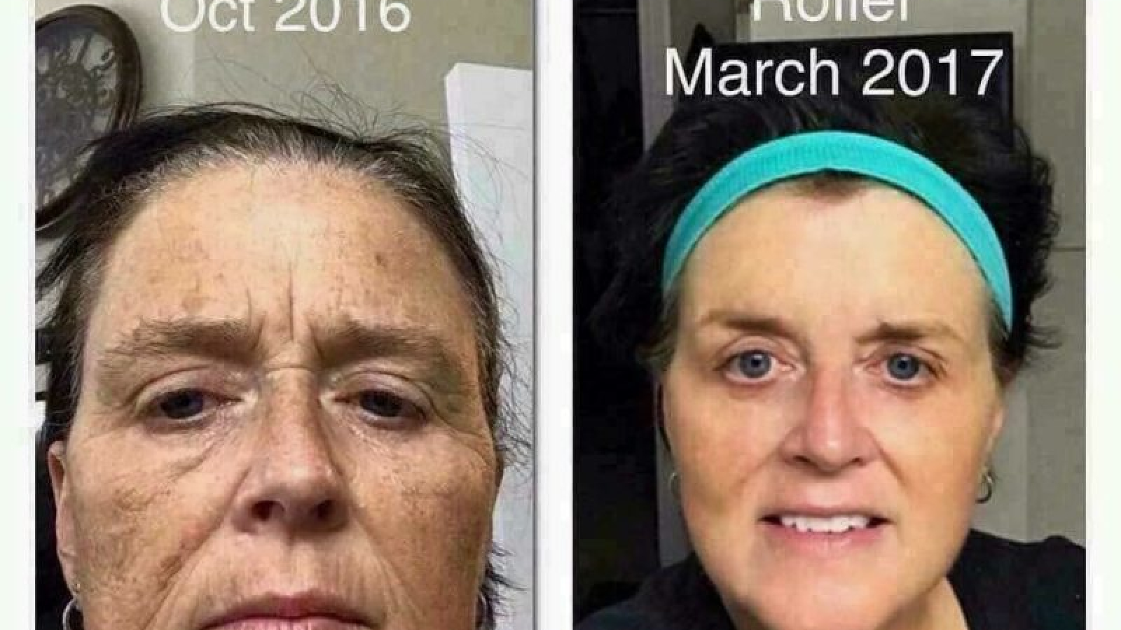 Beauty regimine to get rid of wrinkles