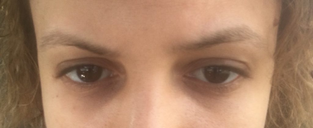 Eyebrows before Microblading