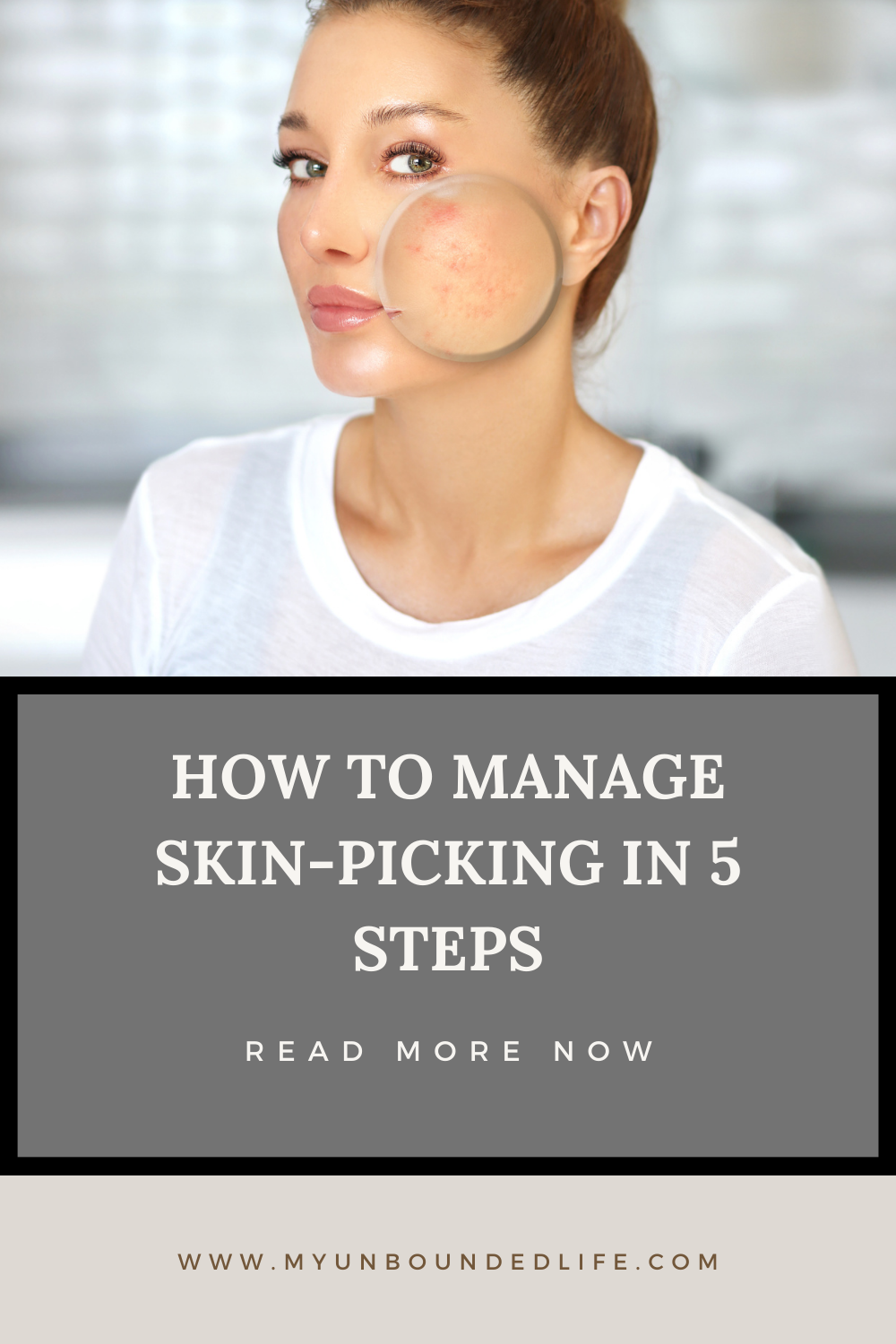 HOW TO MANAGE SKIN-PICKING IN 5 STEPS